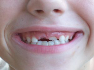 Burke family dental treatments