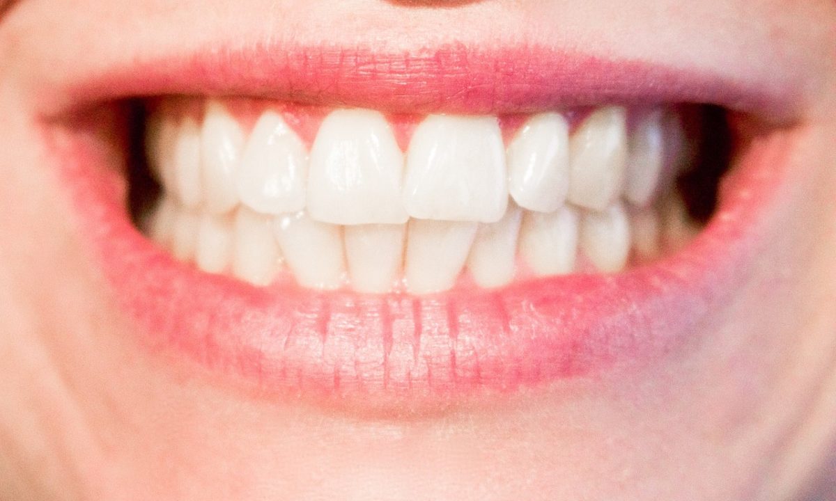 Top Signs You May Have Weak Enamel - Burke Family & Cosmetic Dentistry