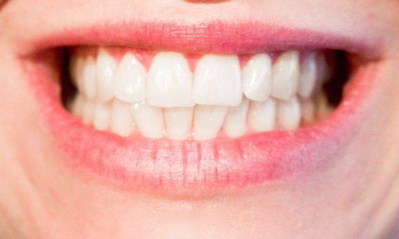 teeth-1652976_1280-1280x768