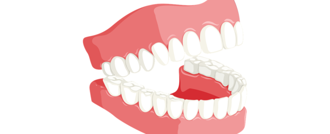 teeth-3414722_1280