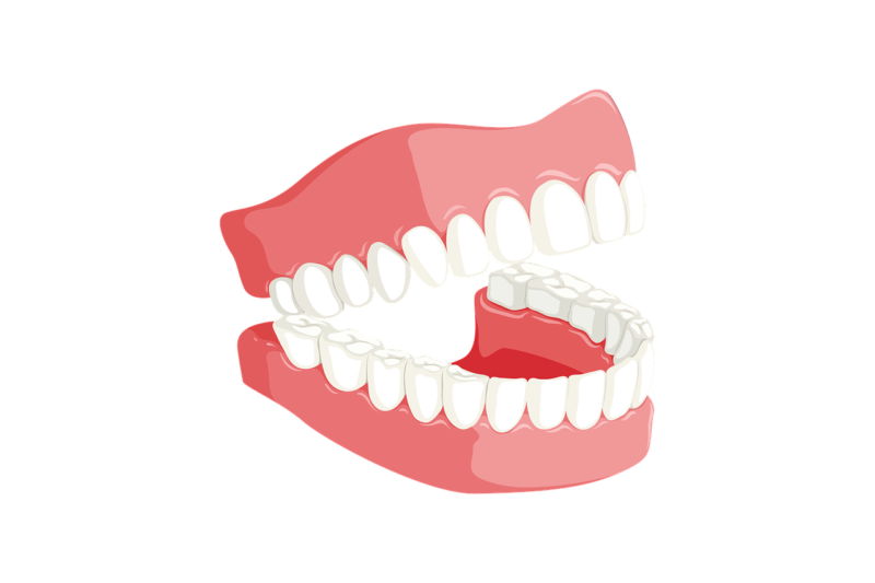 teeth-3414722_1280